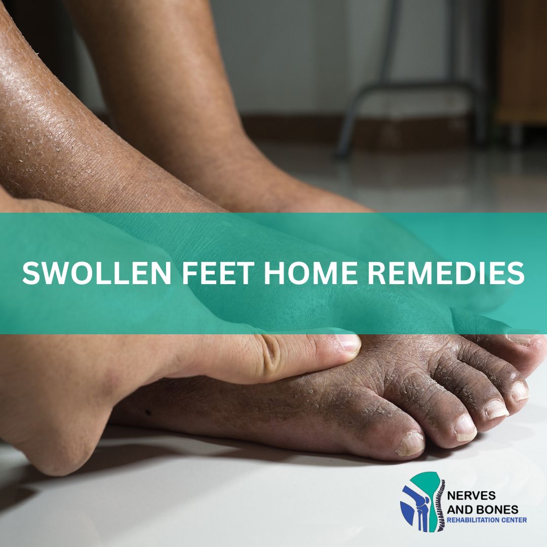 SWOLLEN FEET HOME REMEDIES Nerves Bones Rehabilitation Center